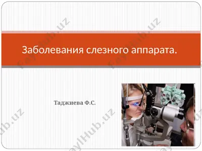 заболевания слезного аппарата — PPT