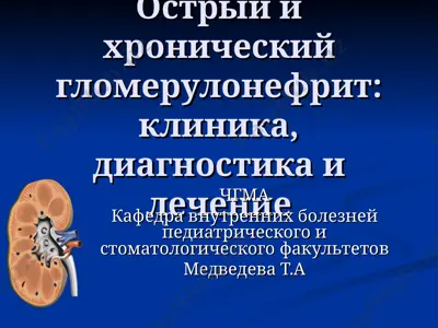 острый и хронический гломерулонефрит: клиника, диагностика и лечение — PPT