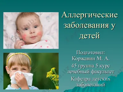 аллергические заболевания у детей — PPT