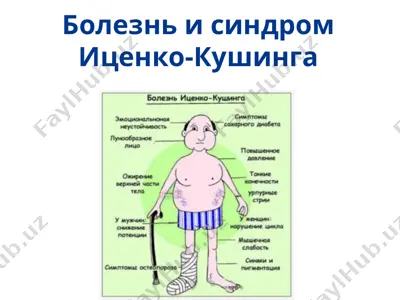 болезнь и синдром иценко-кушинга — PPT