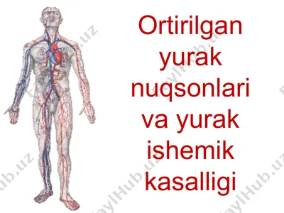 ortirilgan yurak nuqsonlari va yurak ishemik kasalligi — PPT
