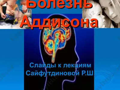 болезнь аддисона — PPT