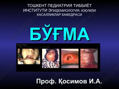 bўғма — PPT