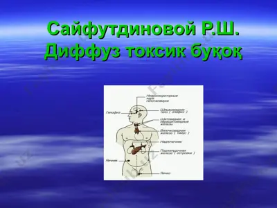 диффуз токсик буқоқ — PPT