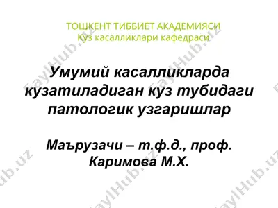 kandli diabet va uning kuzi — PPT