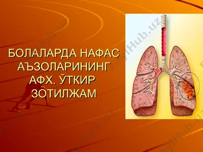 bolalarda nafas a'zolarining afh. ŏtkir zotiljam — PPT