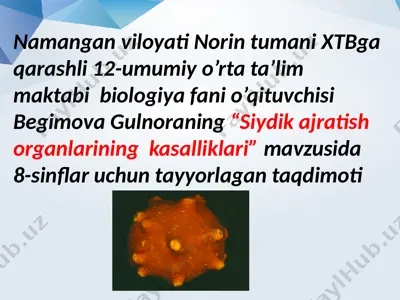 siydik ajratish organlarining kasalliklari — PPTX
