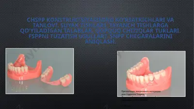 chspp konstruktsiyasining ko’rsatkichlari va tanlovi — PPTX