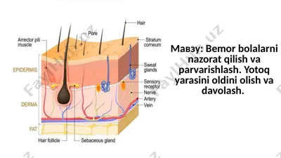 bemor bolalarni nazorat qilish va parvarishlash. yotoq yarasini oldini olish va davolash. — PPTX
