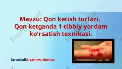 qon ketish turlari. qon ketganda 1-tibbiy yordam ko’rsatish texnikasi — PPTX