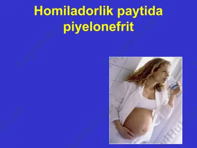 piyelonefrit — PPTX
