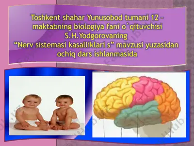 "nerv sistemasi kasalliklari" ochiq dars ishlanmasi — PPTX