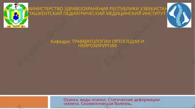 осанка, виды осанки. статические деформации скелета. сколиотическая болезнь. — PPTX