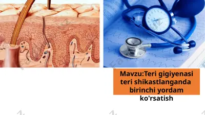 teri gigiyenasi teri shikastlanganda birinchi yordam ko'rsatish — PPTX