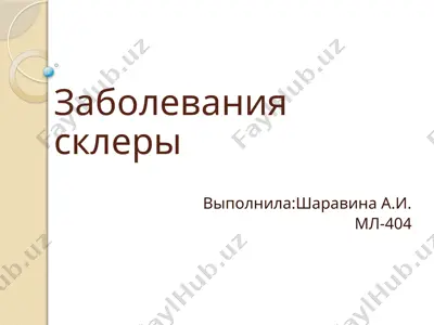 заболевания склеры — PPTX