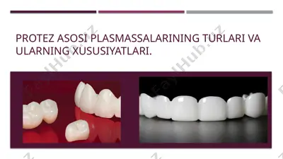 protez asosi plasmassalarining turlari va ularning xususiyatlari — PPTX