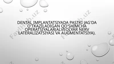 dental implantatsiyada pastki jag'da o'tkaziladigan qo'shimcha operatsiyalar (alveolyar nerv lateralizatsiyasi va augmentatsiya) — PPTX