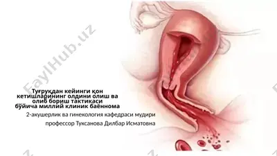 milii klinik bayonnoma - tuğruqdan keyingi qon ketishlarining oldini oliş va olib borish taktikasi bo'yĭicha — PPTX