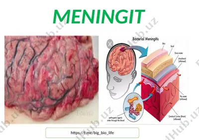 meningit va ensefalit to'g'risida rasmlar to'plami — DOCX