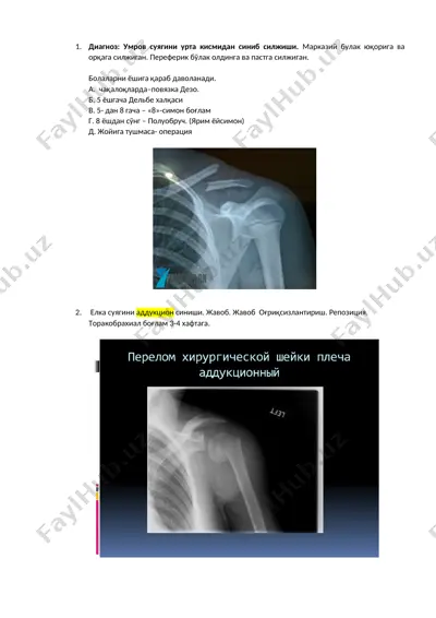 uvrov suyagini urta kismidan sini... — DOCX