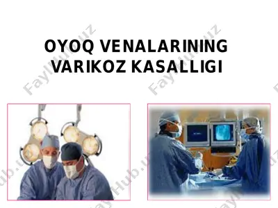 venalarining varikoz kasalligi — PDF