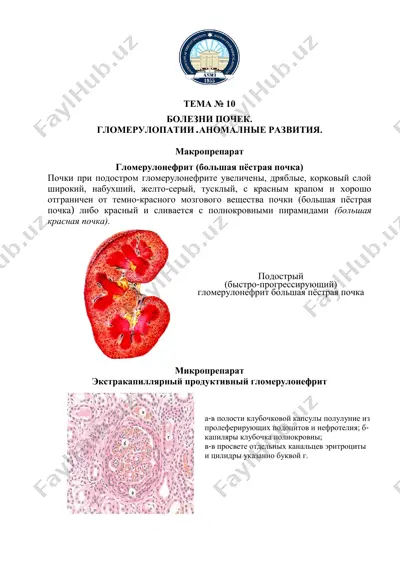 гломерулонефрит (большая пёстрая почка) — PDF