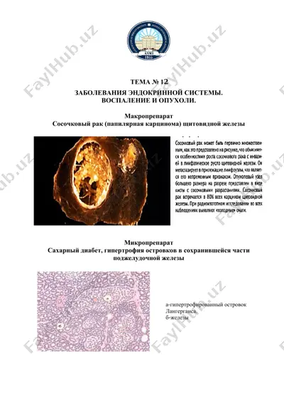 заболевания эндокринной системы. воспаление и опухоли. — PDF