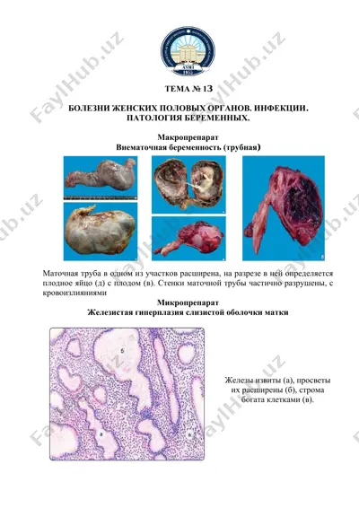 bolezni jenskikh polovykh organov. infektsii. patologiya beremennykh. — PDF