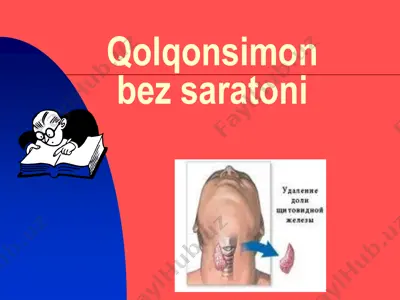 qolqonsimon bez saratoni — PDF