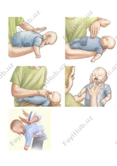 yosh bolaning nafas yo'llariga yegulik tiqilgandagi ilk yordam — DOCX
