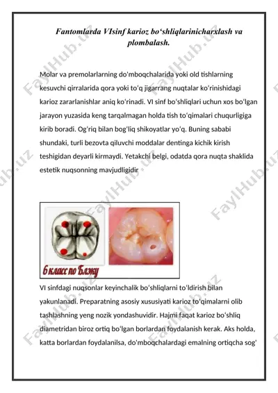 visinf karioz bo‘shliqlarinicharxlash va plombalash — DOCX