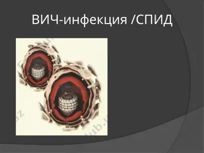 вич-инфекция спид — PPTX