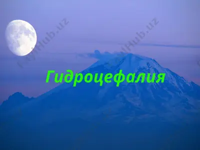 гидроцефалия — PPT