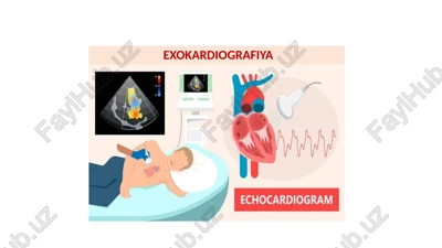 exokardiografiya — PPTX