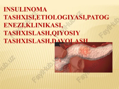 insulinoma tashxisi, etiologiyasi, patogenezi, klinikasi — PPTX
