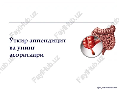 o'tkir appenditsit va uning asoratlari — PPTX