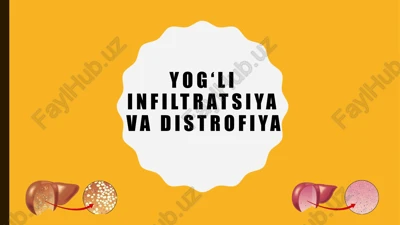 distofiya — PPTX