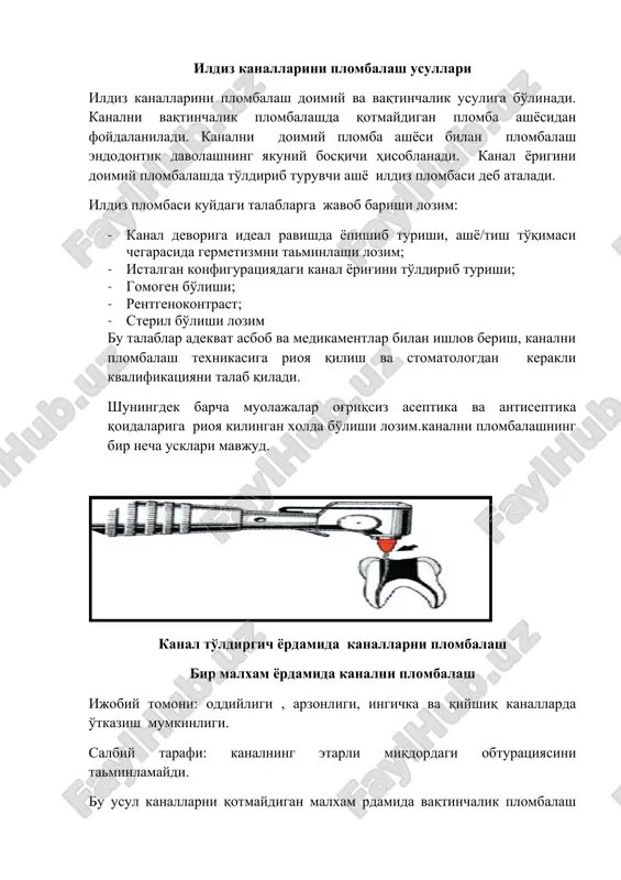 ildiz kanallarini plombalash usullari — DOC