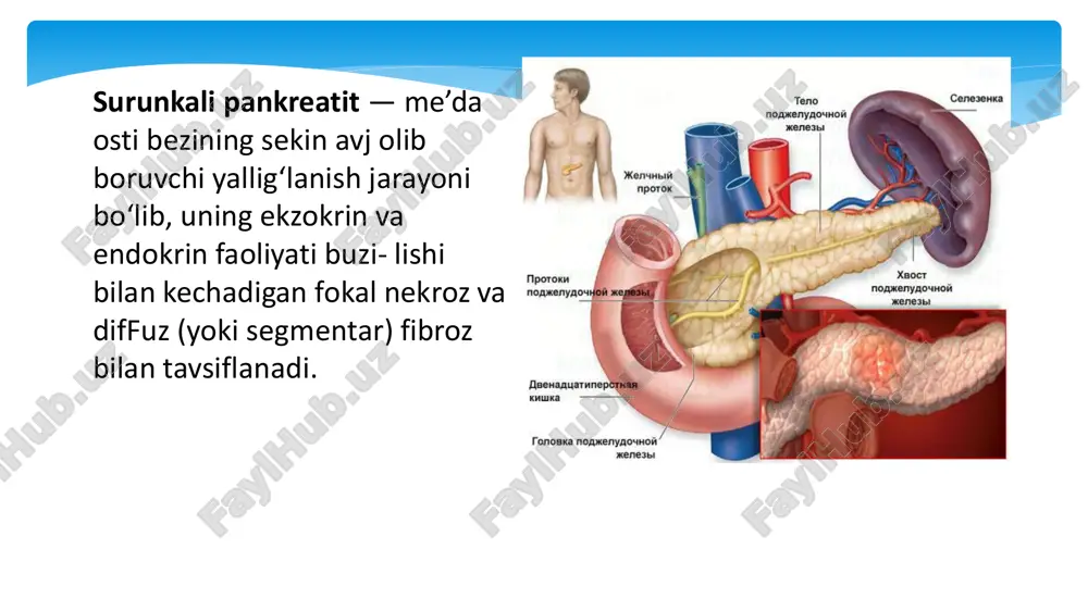 surunkali pankreatit — PDF