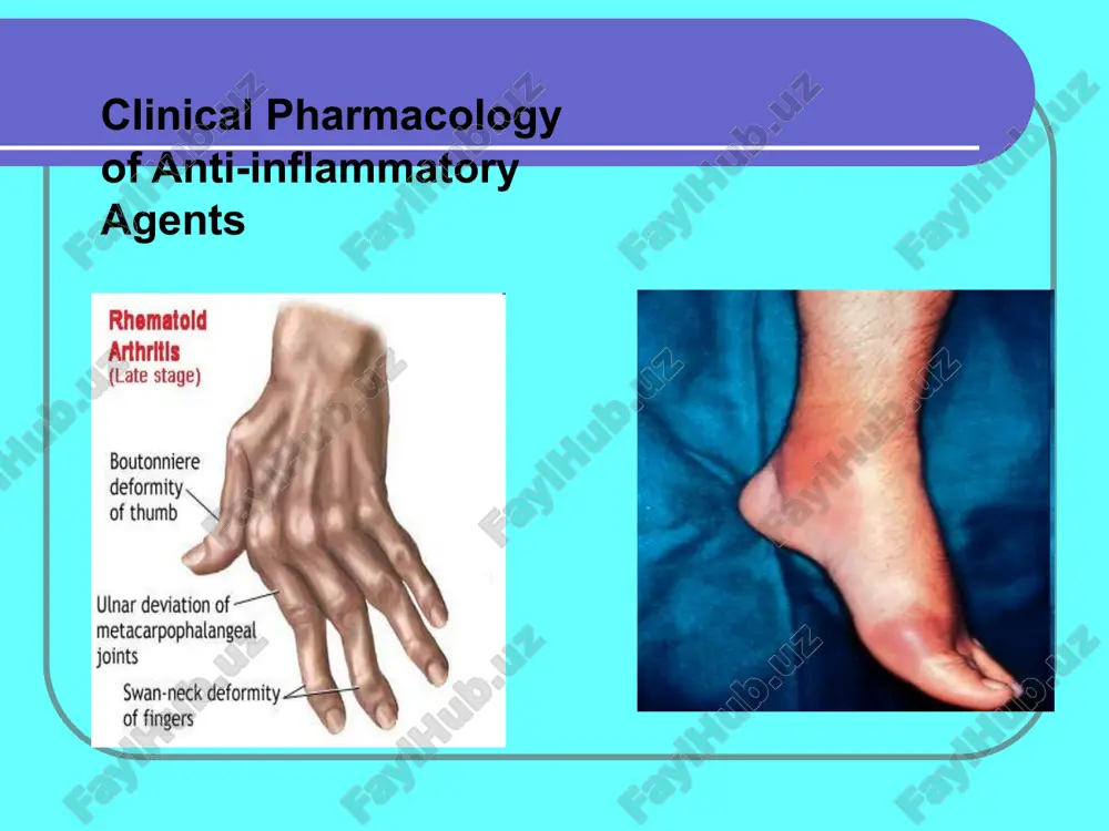 boutonniere deformity — PPT