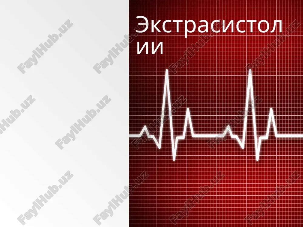 ekstrasistolii — PPT
