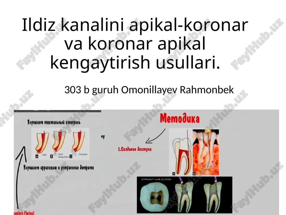 ildiz kanalini apikal-koronar vakoronar apikal kengaytirish usullari — PPTX