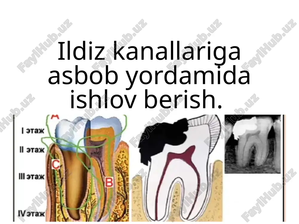 ildiz kanallariga asbob yordamida ishlov berish — PPTX