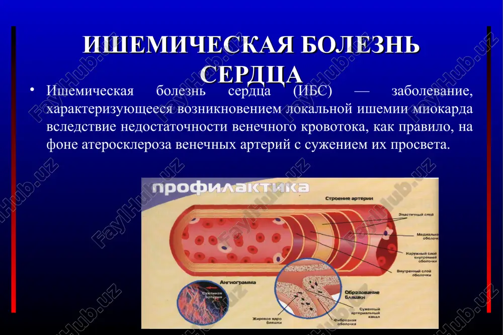 ishemicheskaya bolezn serdtsa — PPT