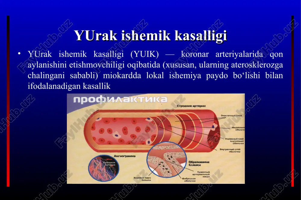 yurak ishemik kasalligi — PPT