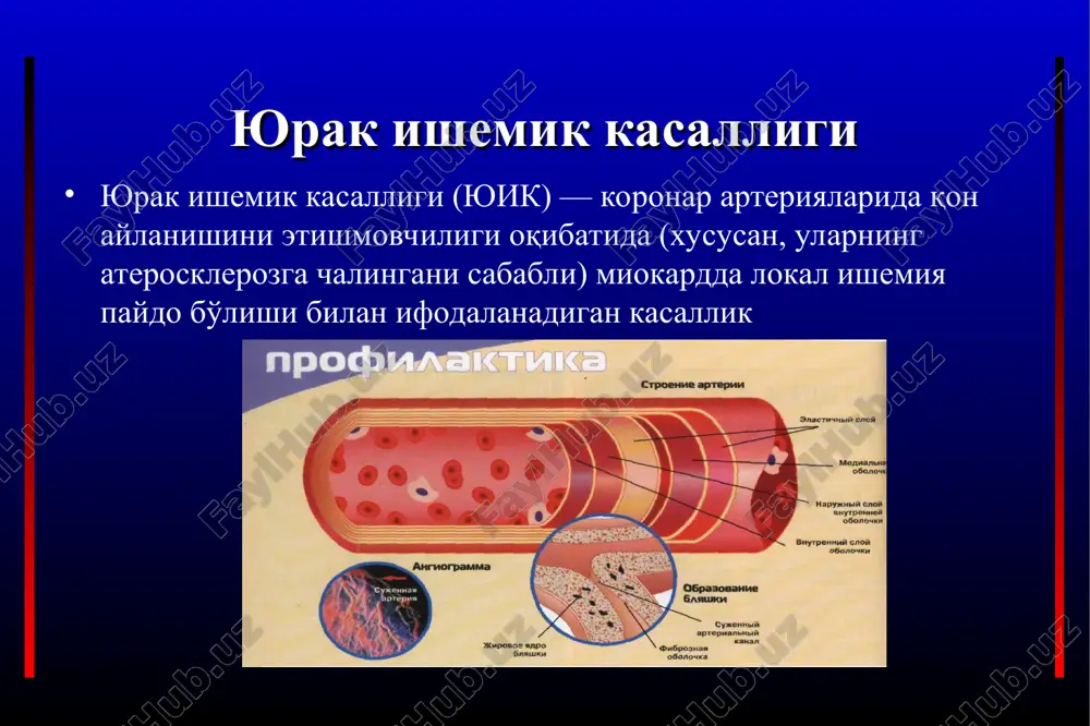 yurak ishemik kasalligi — PPT