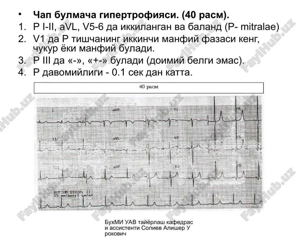 qalbiy bolumning hipertrofiyasi — PPT