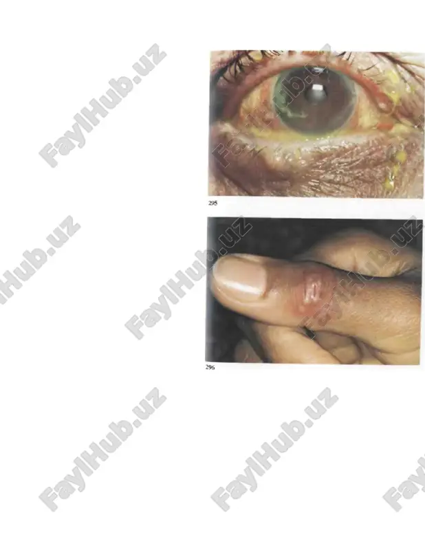 gerpesvirusi — PPTX