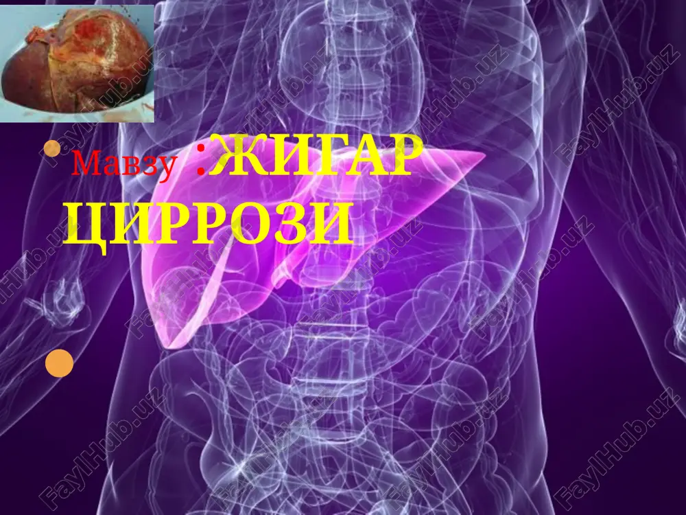jigartsirrozi — PPTX