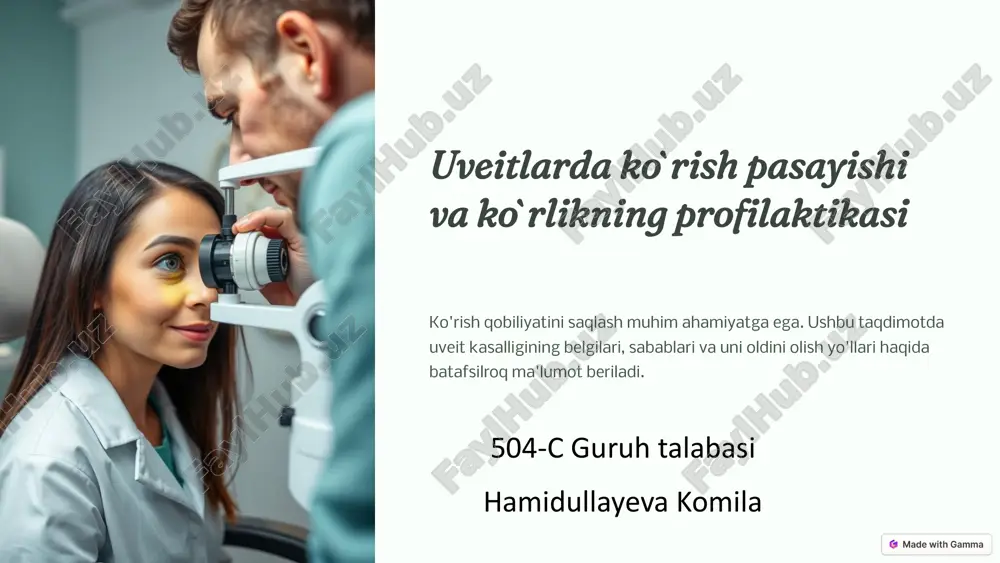 uveitlarda ko`rish pasayishi va ko`rlikning profilaktikasi — PPTX
